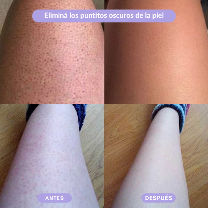 Wavy™ - Depiladora de Cristal Suave